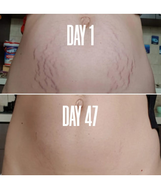 B-FLAT Belly Firming Cream