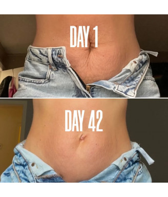 B-FLAT Belly Firming Cream